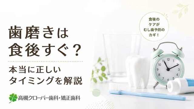 歯磨きは食後すぐ？本当に正しいタイミングを解説