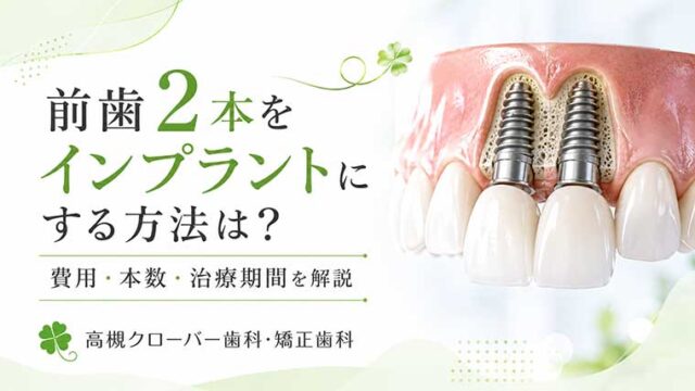 前歯2本をインプラントにする方法は？費用・本数・治療期間を解説