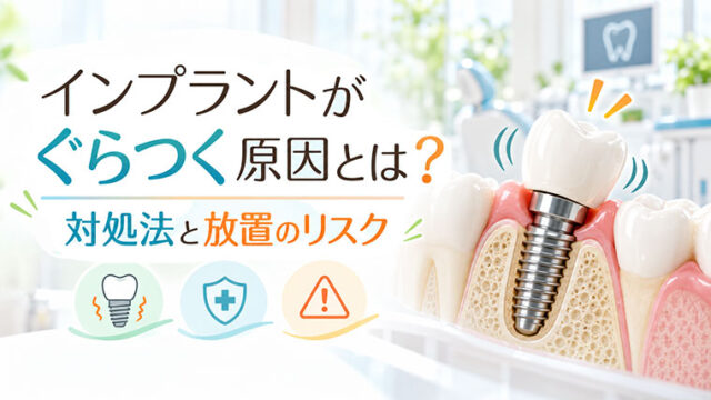 インプラントがぐらつく原因とは？対処法と放置のリスク