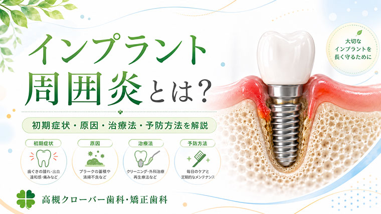 インプラント周囲炎とは？初期症状・原因・治療法・予防方法を解説