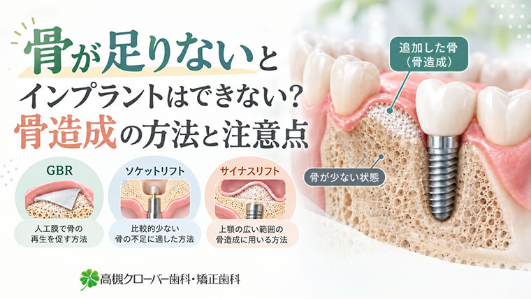 骨が足りないとインプラントはできない？骨造成の方法と注意点