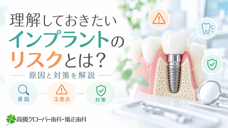理解しておきたいインプラントのリスクとは？原因と対策を解説