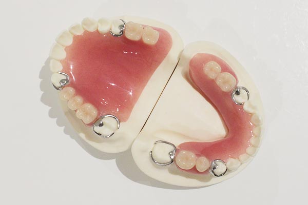 レジン床義歯(保険の入れ歯)