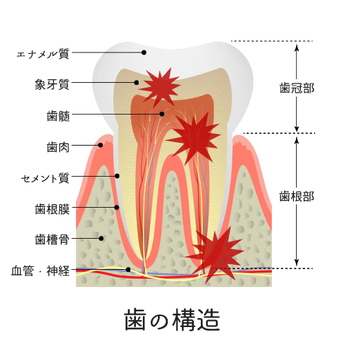 歯の構造・歯の痛みが出る場所