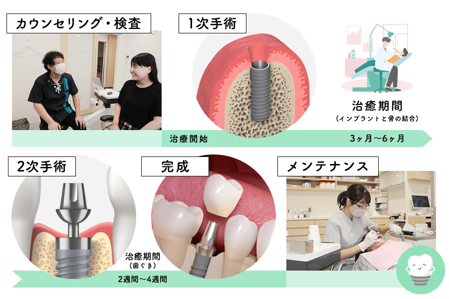 インプラント治療｜JR高槻駅徒歩3分【高槻クローバー歯科】